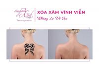 XÓA XĂM VĨNH VIỄN - KHÔNG LO VỀ SẸO